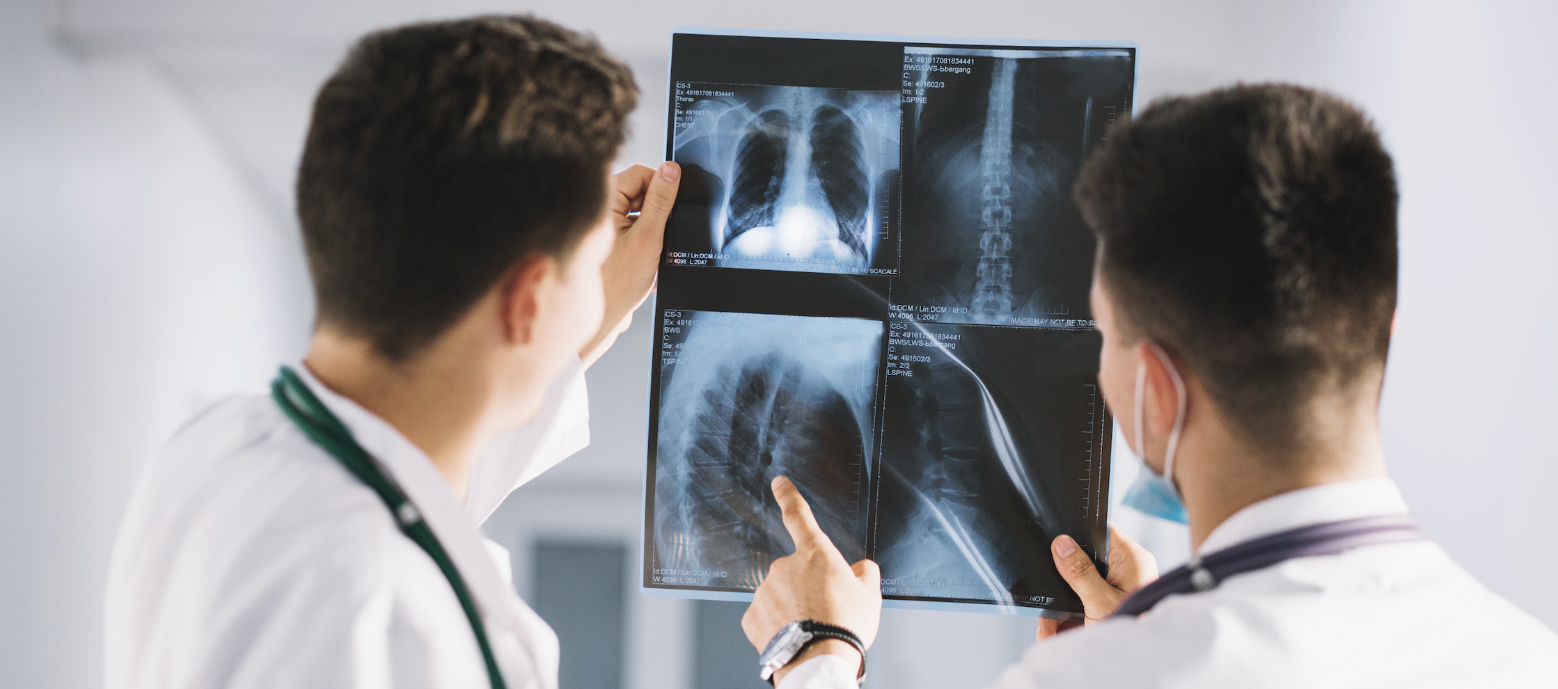 Radiografie digitală