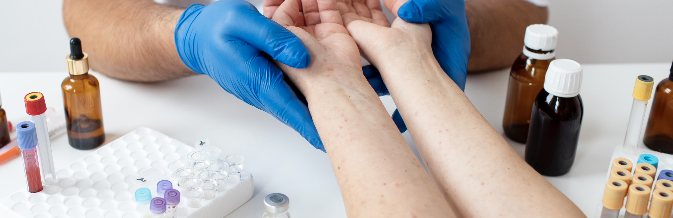 Alergologie – Imunologie