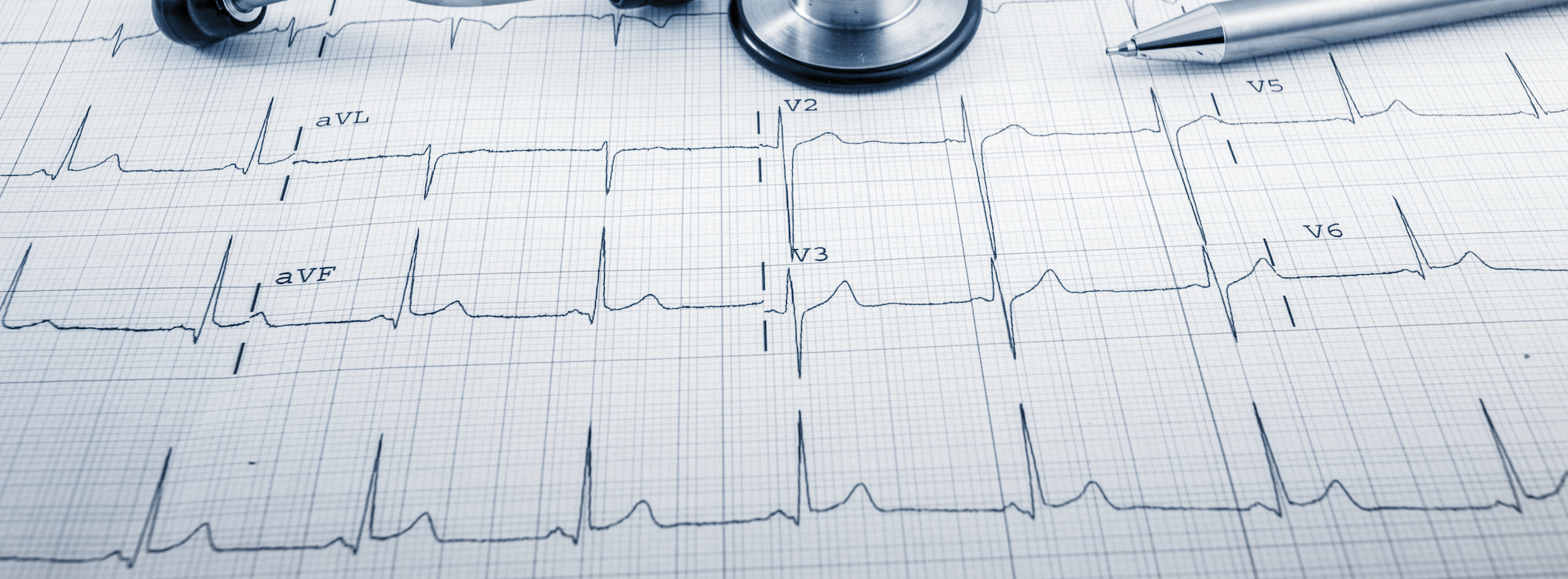 Electrocardiografie ECG (12 derivații)