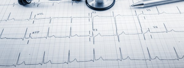 Electrocardiografie ECG (12 derivații)